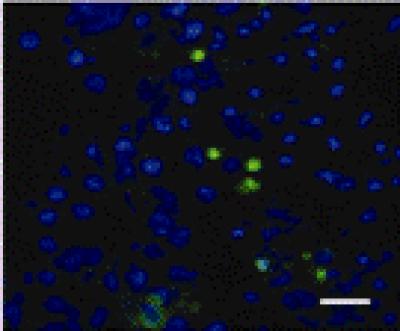 Apoptotic Cells