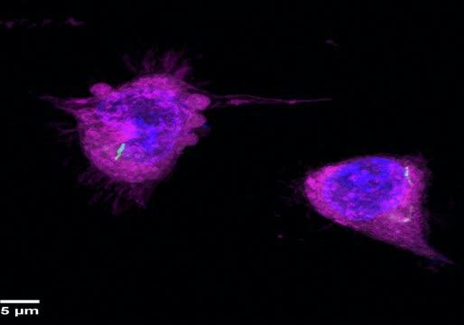 Fluorescent Probe Sheds Light on Tuberculosis Bacteria (2 of 2)