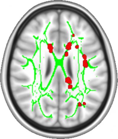 A Map of Chronic Pain