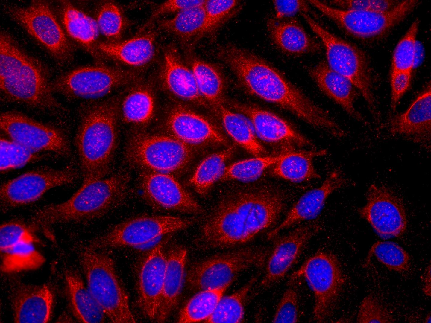 Skin Cancer Cells and IgE