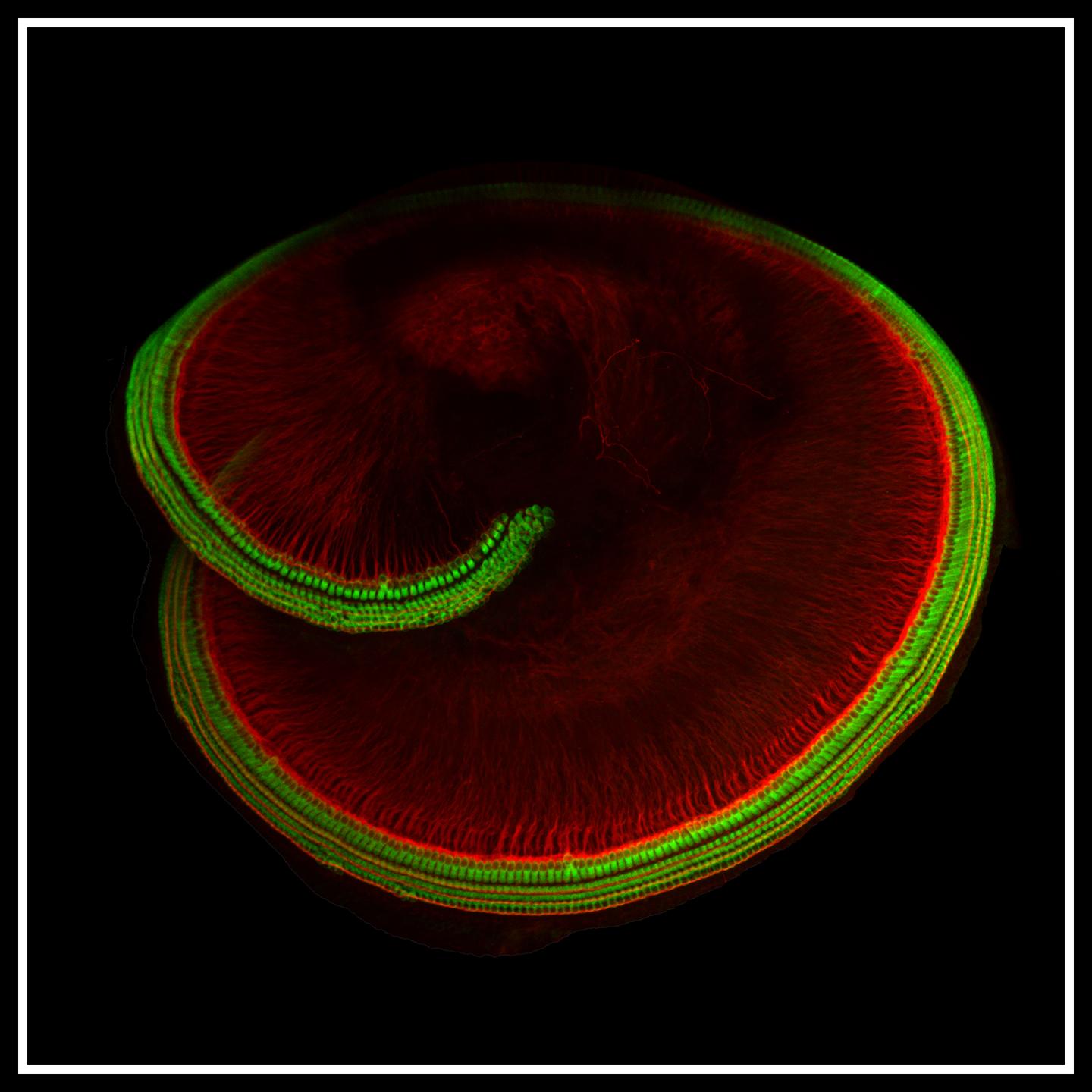 Scientists Pinpoint Identity of Elusive Hearing Molecule