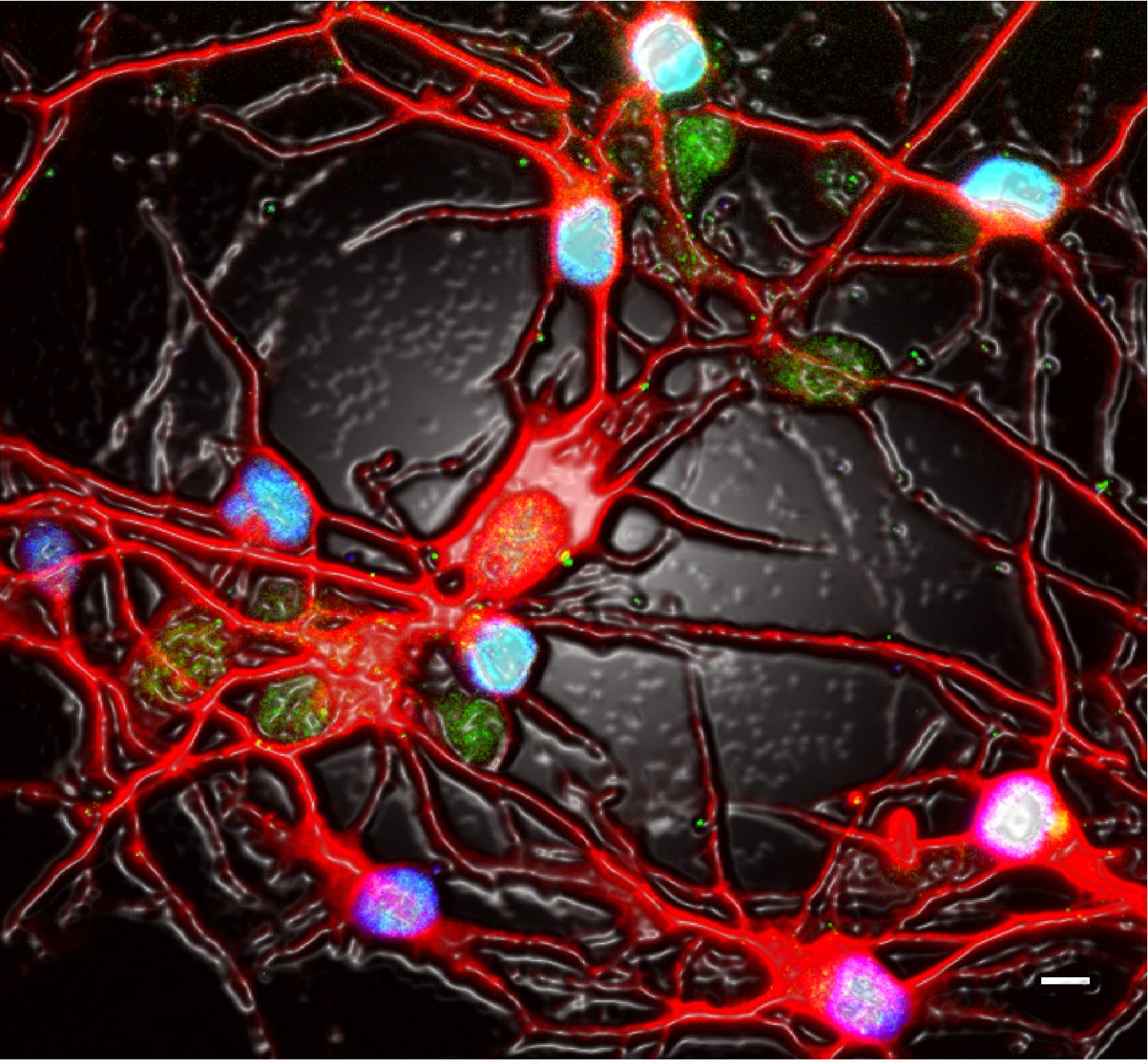 When Neurons Get the Blues