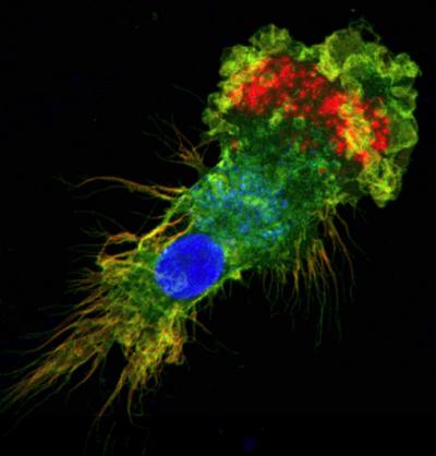 Dendritic Cell Engulfs Probiotic Vaccine (1 of 2)