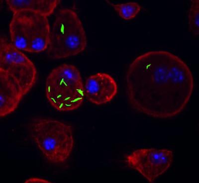 Macrophages Infected with <i>Mycobacterium tuberculosis</i>