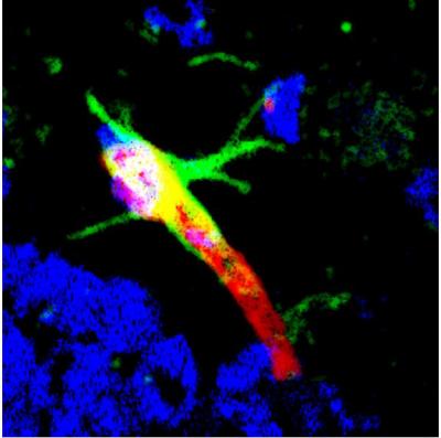 Image Shows Dag (Green-Labeled Peptide) Targeting to the Brain Blood Vessel