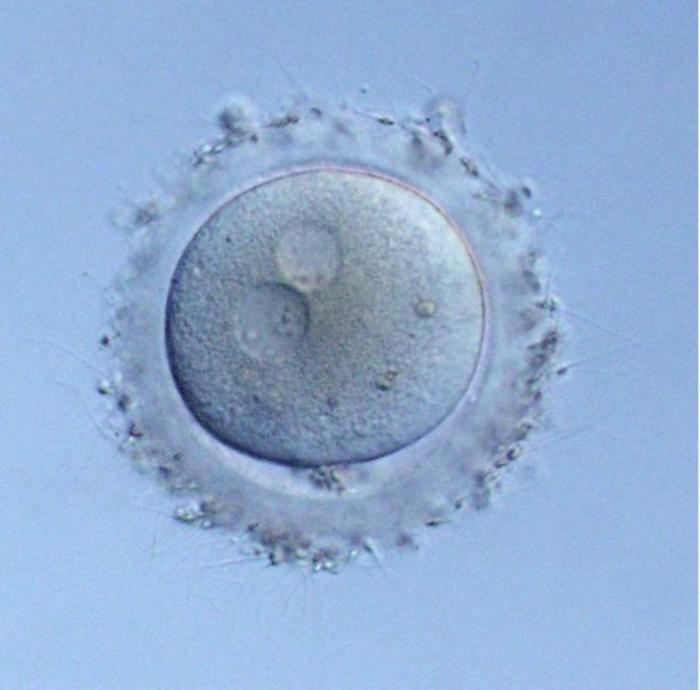 A human embryo obtained through in vitro fertilization (IVF).