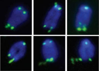 Fragile Telomeres