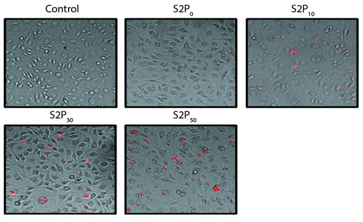 Tiny Particles Keeps Artery Plaques in Check in Mouse Models of Atherosclerosis (1 of 2)