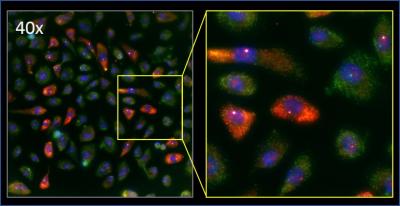 MYC Gene Image