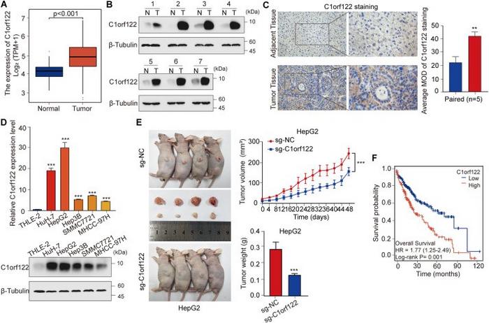 C1orf122 was upregulated in HCC patients and correlated with poor survival outcome.