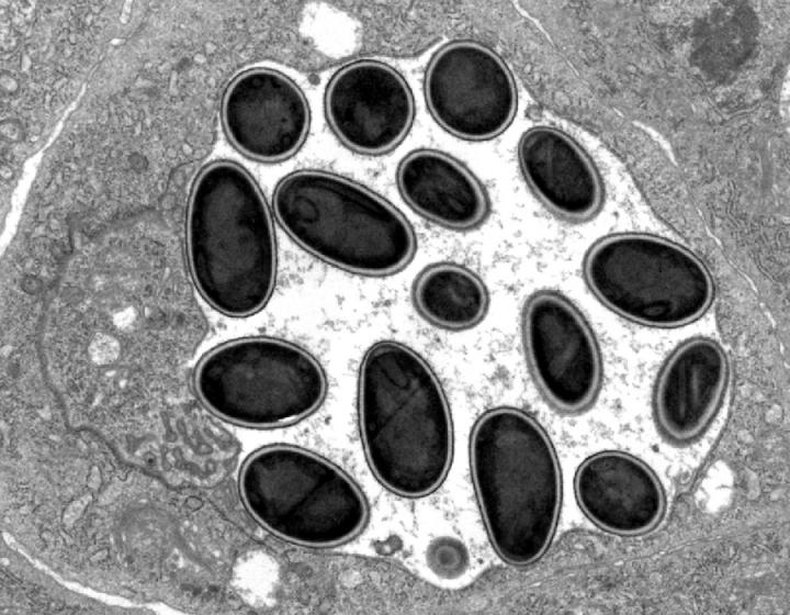 Microsporidium <i>M. daphniae</i>