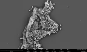 Electron microscope image of methanogens