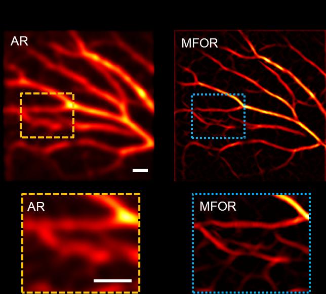 Figure 3. In vivo experimental images of the blood vasculature in a mouse ear.