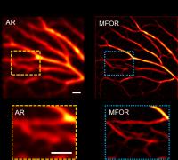 Figure 3. In vivo experimental images of the blood vasculature in a mouse ear.