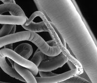 Whipworm
