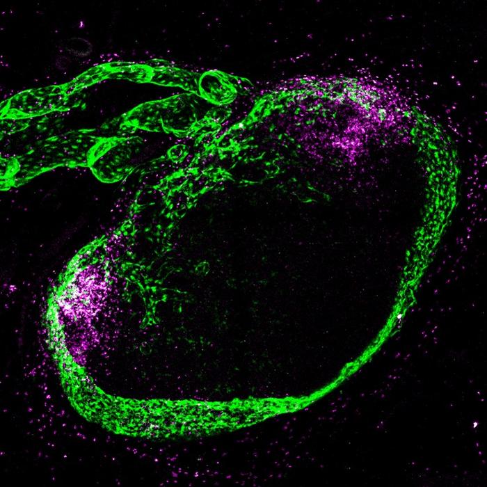 Draining lymph node