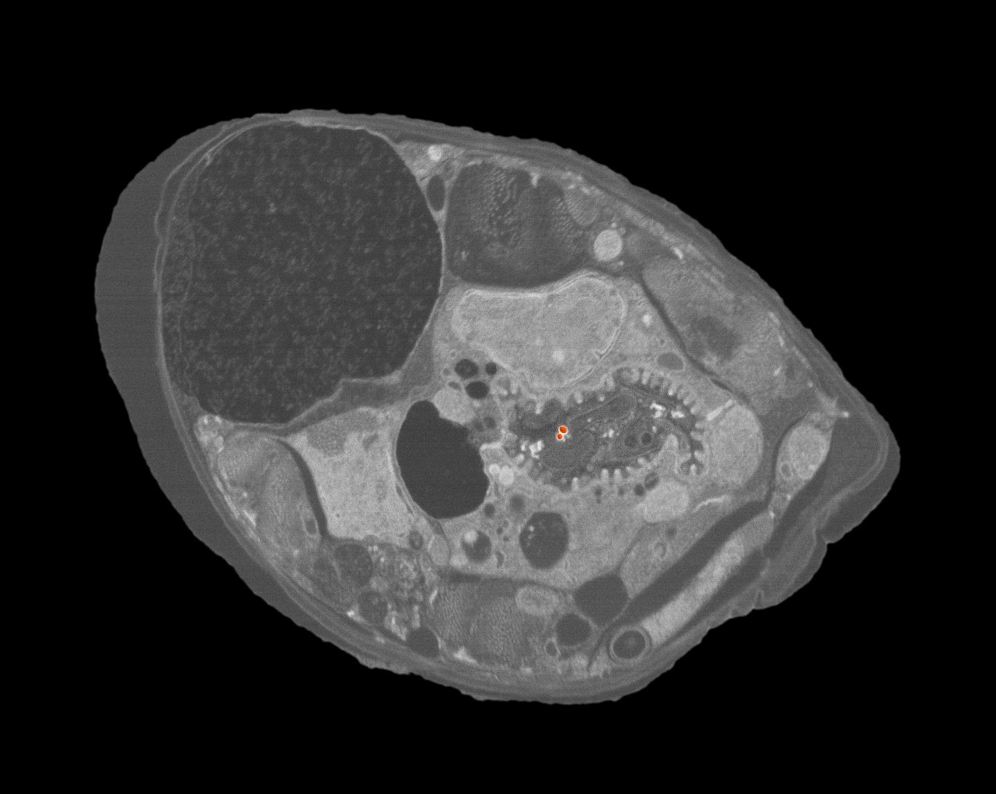 Visual Confirmation of Ingested Nanoparticles