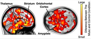 Brain opioids and music