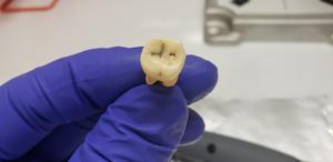 Jerash tooth 2 - May 2022 - Credit Greg O'Corry FAU-Crowe