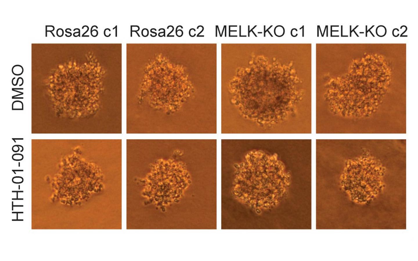 A Suspect in Cancer Is Exonerated