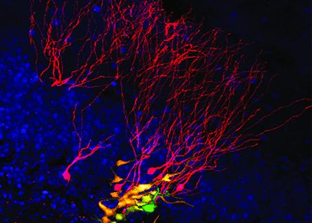 Stem Cells Evolving into Nerve Cells