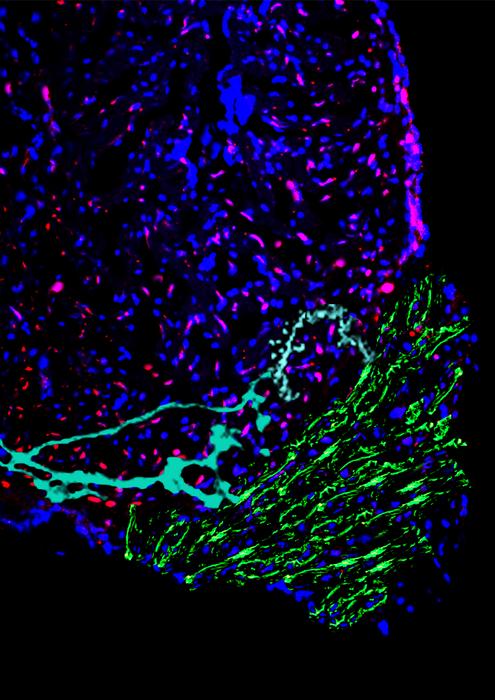 Section of a cryo-injured zebrafish heart