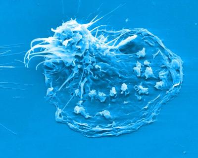 Dendritic Cell