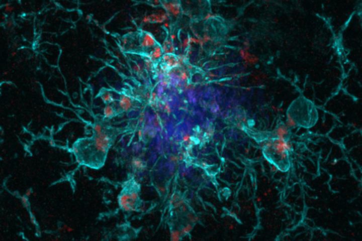 Microglia around amyloid plaque