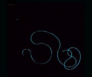 Single Sperm Time Lapse