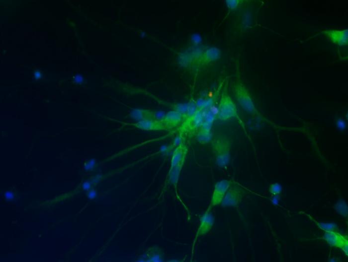 Motor neurons