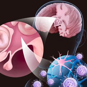 Arginine shows promise as a safe, cost-effective therapy for Alzheimer’s disease