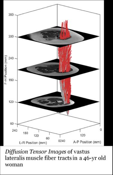 High-Tech Muscle Scan