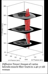 High-Tech Muscle Scan