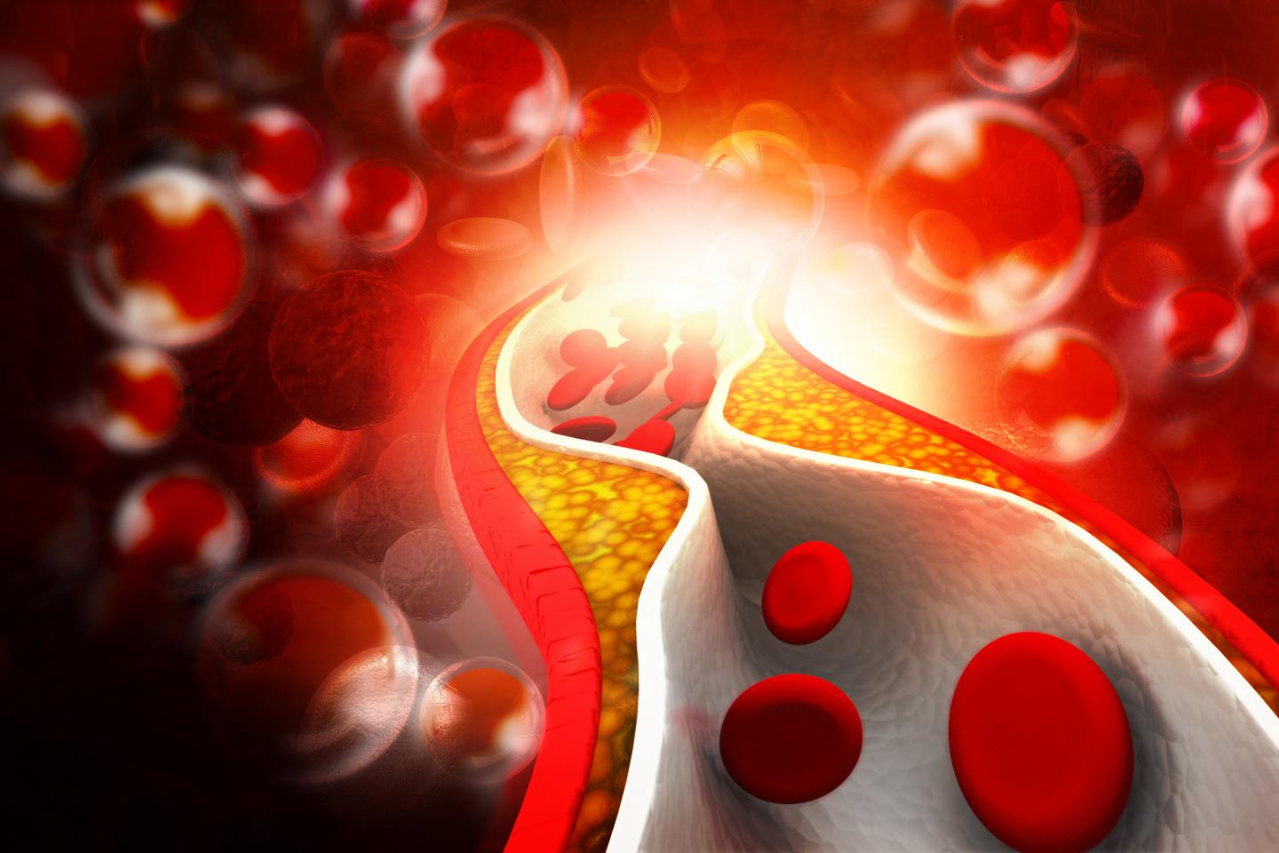 Cholesterol