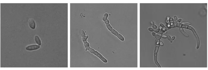 Marine yeast Horatia werneckii switches between single-celled and multicellular forms