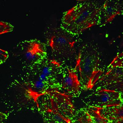 Mammary Epithelial Cells