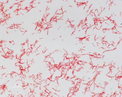 ETBF Gram Stain