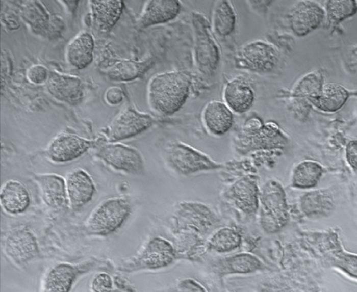 VRAC-deficient macrophages swell under hypo-osmotic conditions