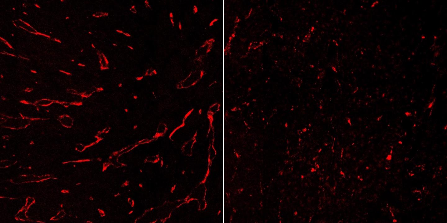 Influence of IFN-γ