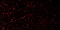 Influence of IFN-γ