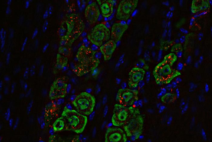 Spherical nucleic acid in trigeminal nerve