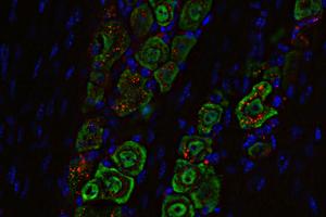 Spherical nucleic acid in trigeminal nerve