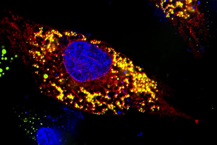 Microscopy of a brain cell infected with Zika virus