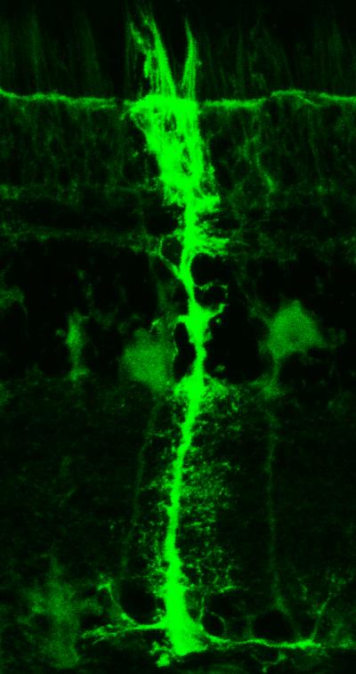 Muller Glia