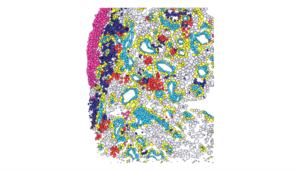Map of cells in inflamed joints of children and young people