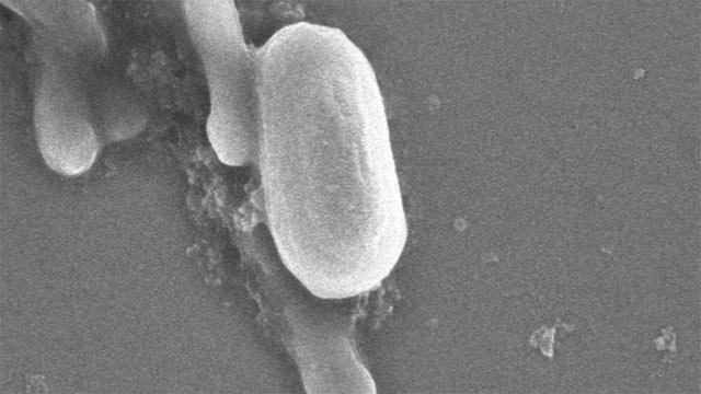 <i>Bacillus timonensis</i>