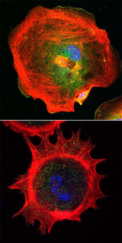 Fibroblasts