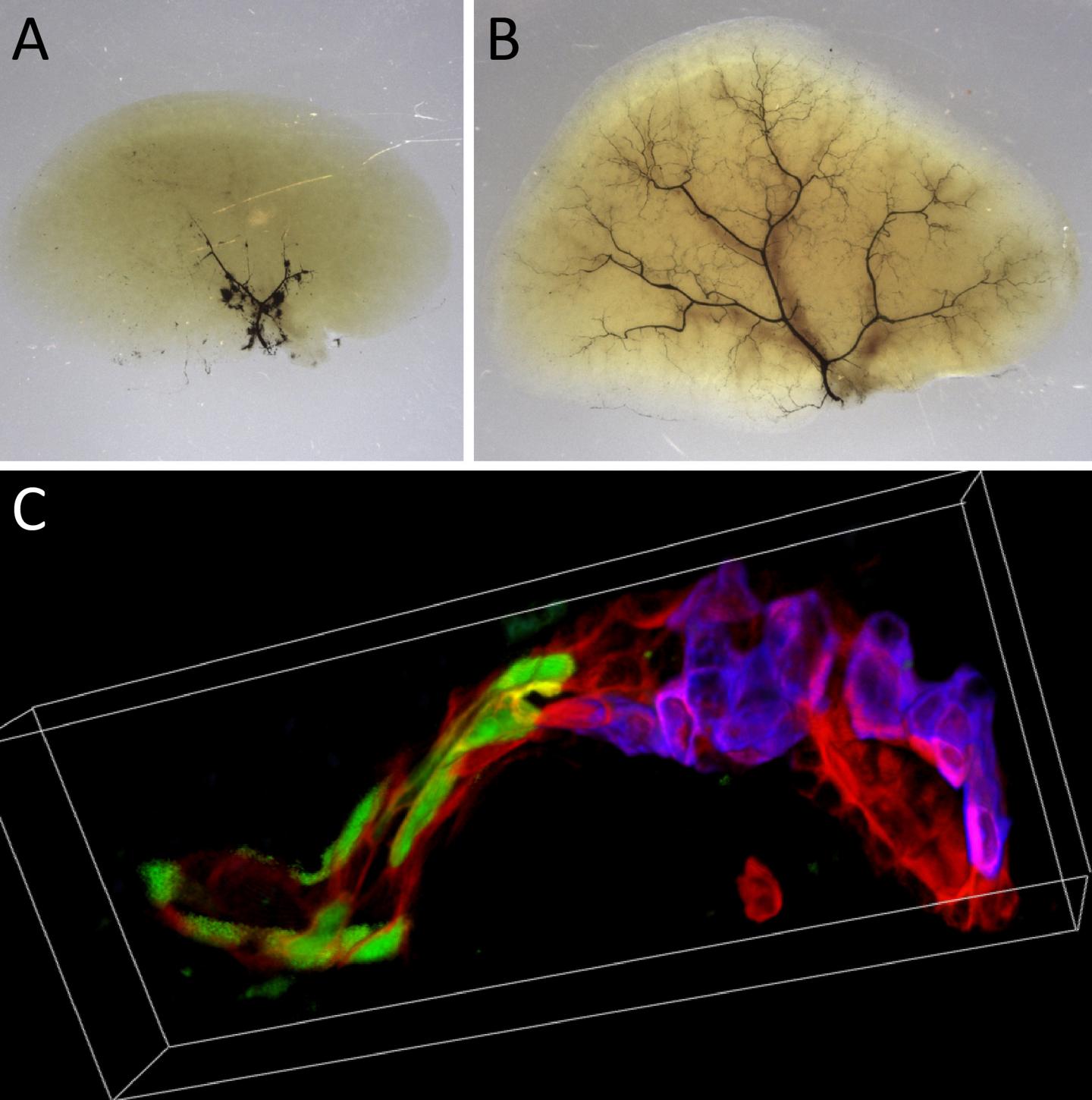 Liver Regeneration