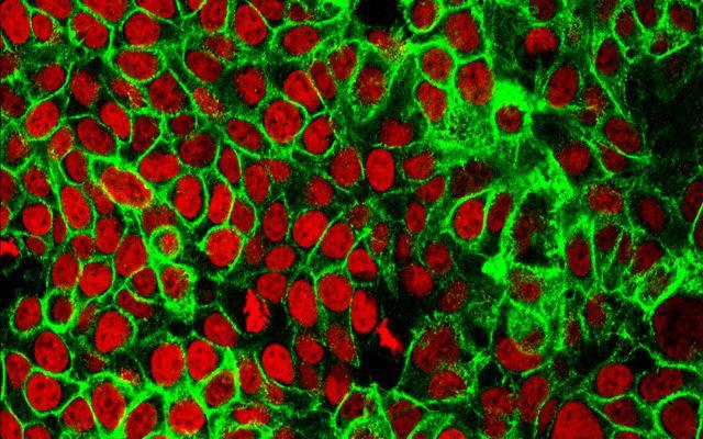 Colon Cancer Cells