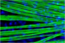 Muscle Fibers
